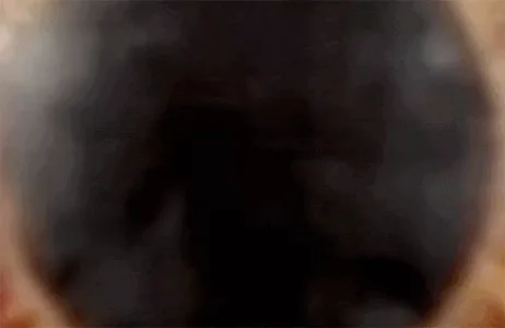 Глазное Яблоко Глаза Арт Дизайн